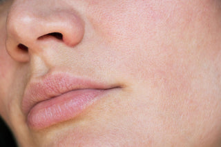 Sensitive Skin - ZO Skin Centre Houston